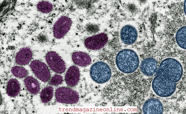 CDC Warning Monkeypox Worldwide Spread International Travel News